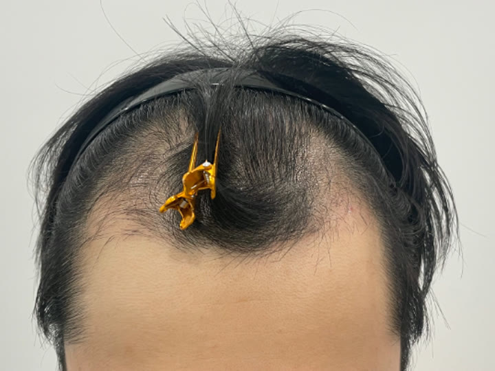 같은 분의 2달 사진