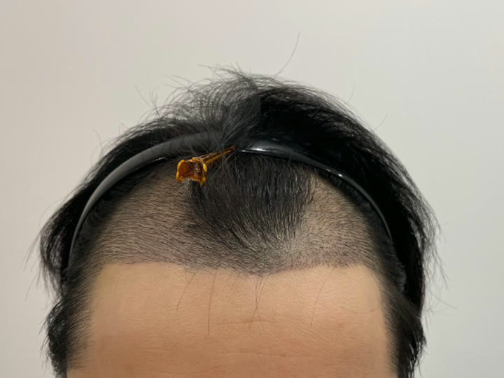 같은 분의 2주 사진