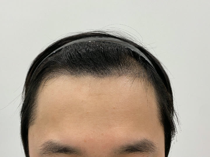 같은 분의 5개월 사진